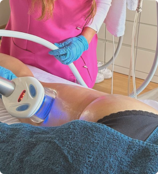 Eximia HR77 behandeling op boven en onderbenen bij schoonheidssalon IsaBeauty