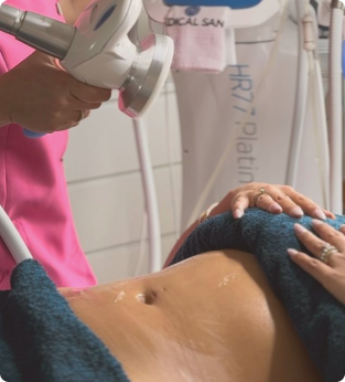 Behandeling Eximia Lichaam voor Buik en taille bij schoonheidssalon IsaBeauty